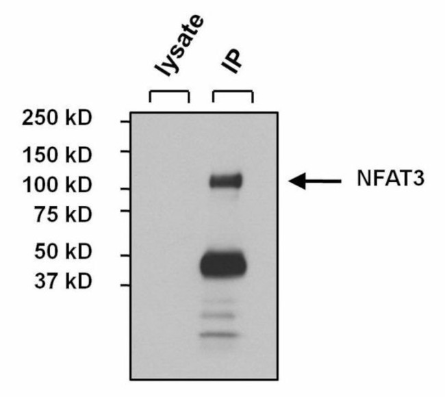 NFATC4 Antibody in Immunoprecipitation (IP)