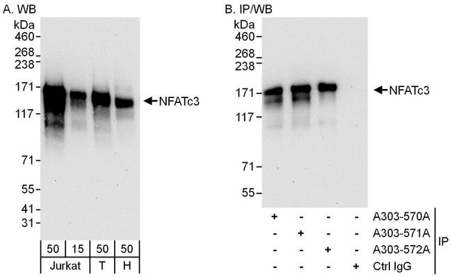 NFATc3 Antibody in Western Blot (WB)