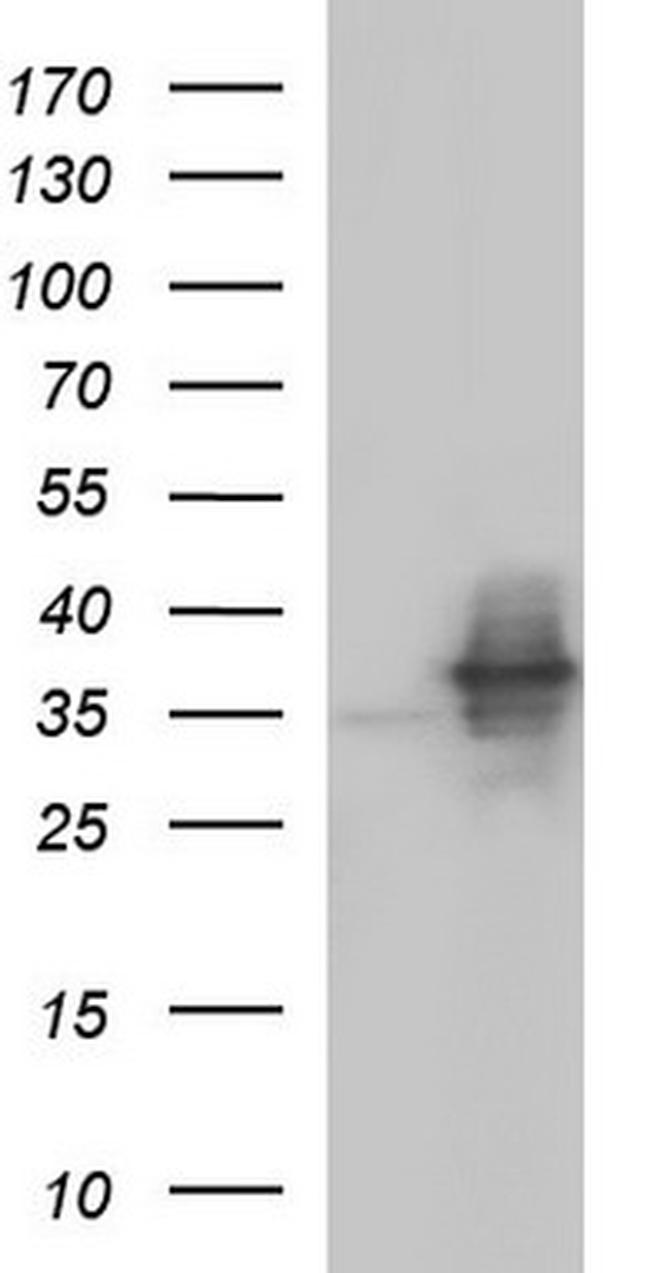 NFKBIA Antibody in Western Blot (WB)