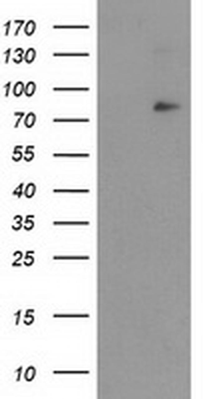 NFKBIZ Antibody in Western Blot (WB)