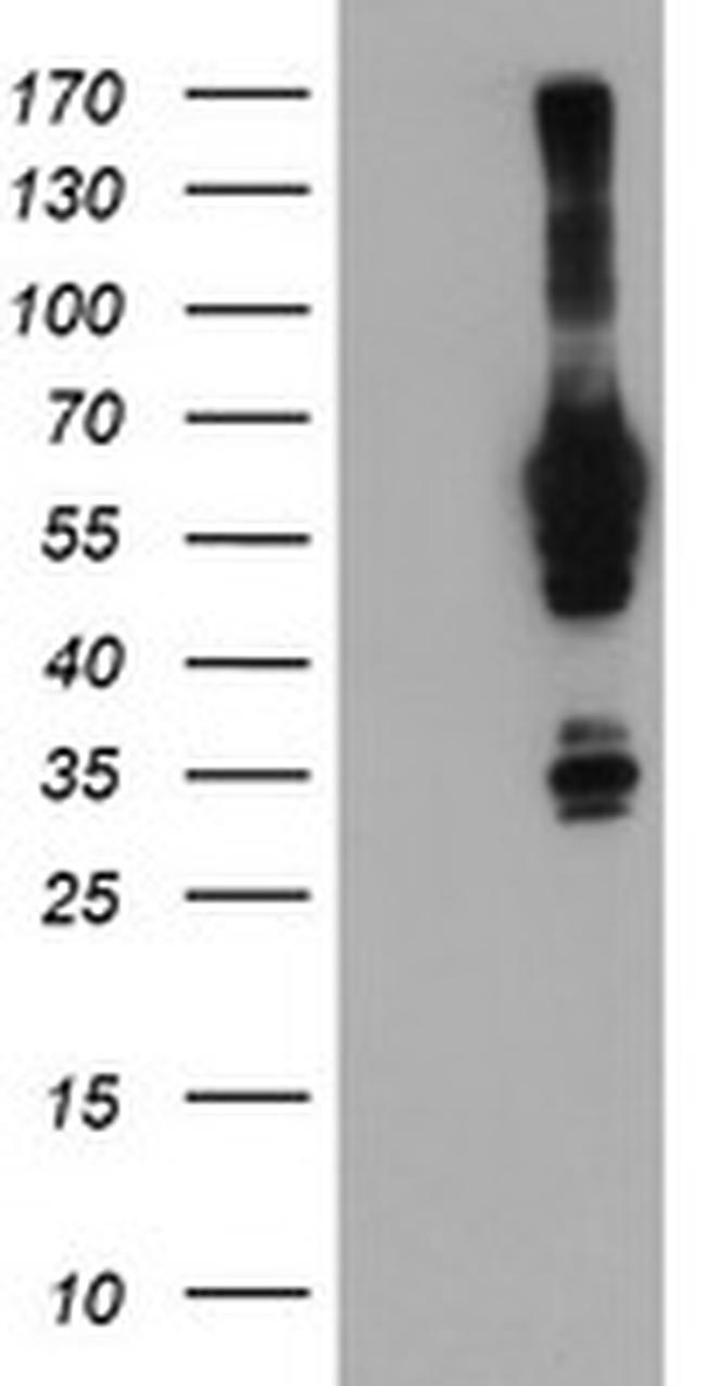 NMT2 Antibody in Western Blot (WB)
