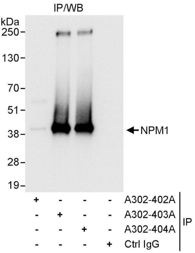 NPM1 Antibody in Immunoprecipitation (IP)
