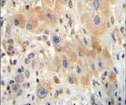NR0B2 Antibody in Immunohistochemistry (Paraffin) (IHC (P))