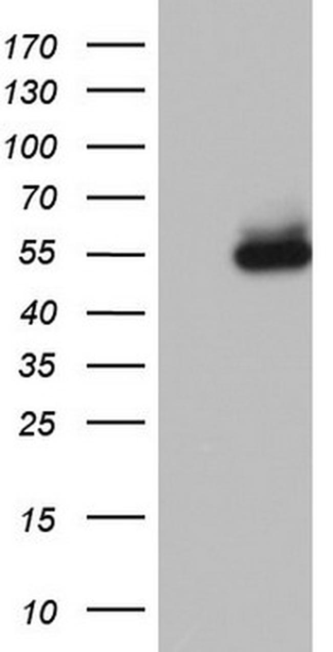 NR2C1 Antibody in Western Blot (WB)