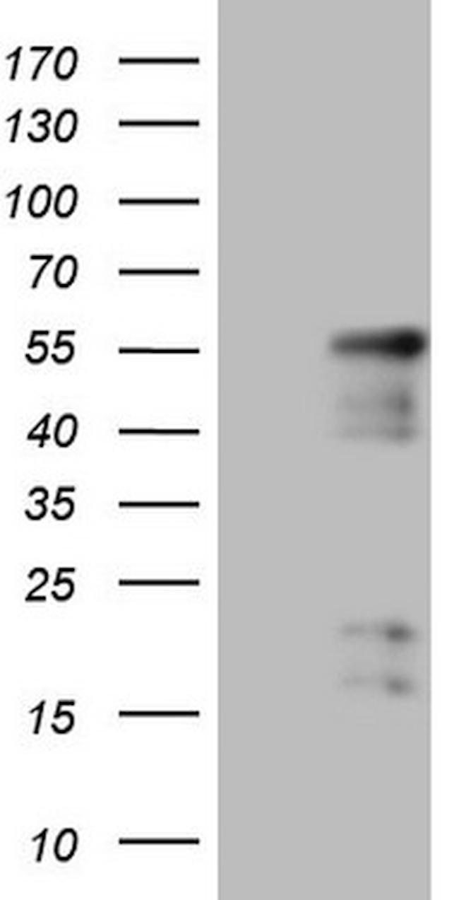 NR2E3 Antibody in Western Blot (WB)