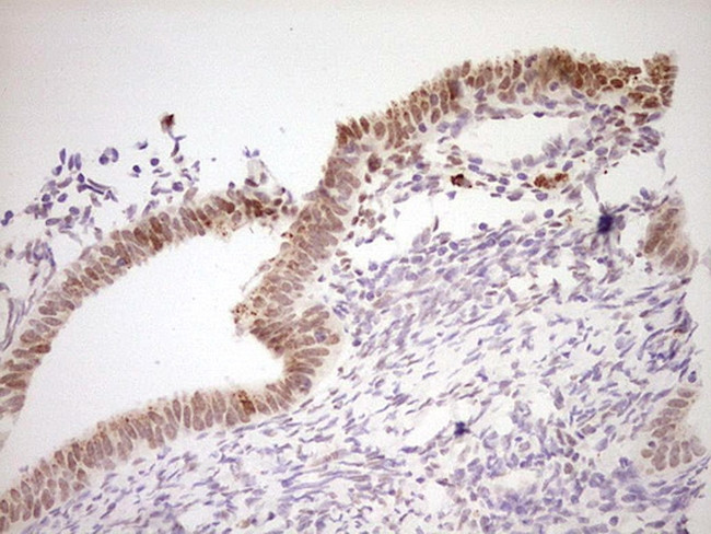 NR4A3 Antibody in Immunohistochemistry (Paraffin) (IHC (P))
