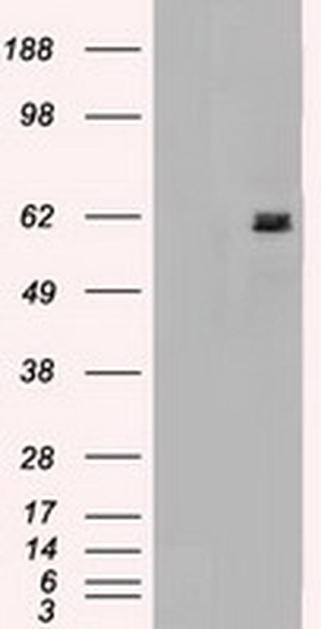 NRBP1 Antibody in Western Blot (WB)