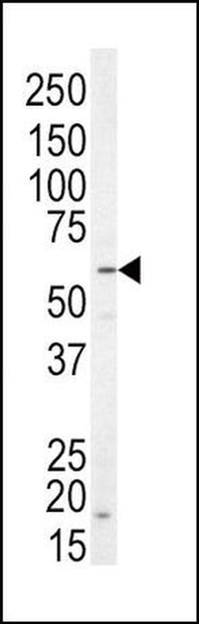 NRG1 Antibody in Western Blot (WB)