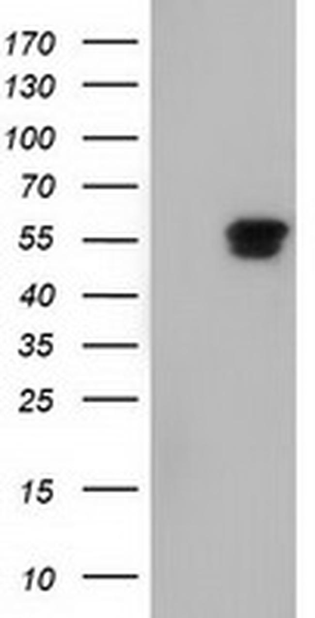 NT5DC1 Antibody in Western Blot (WB)