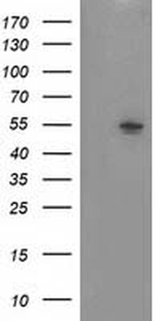 NT5DC1 Antibody in Western Blot (WB)
