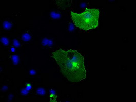 NTRK3 Antibody in Immunocytochemistry (ICC/IF)