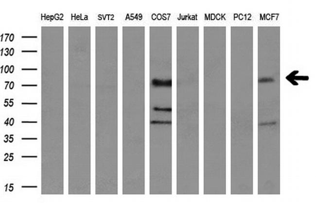 NTRK3 Antibody in Western Blot (WB)