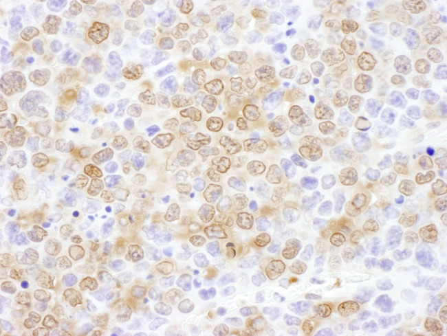 NUDC Antibody in Immunohistochemistry (IHC)