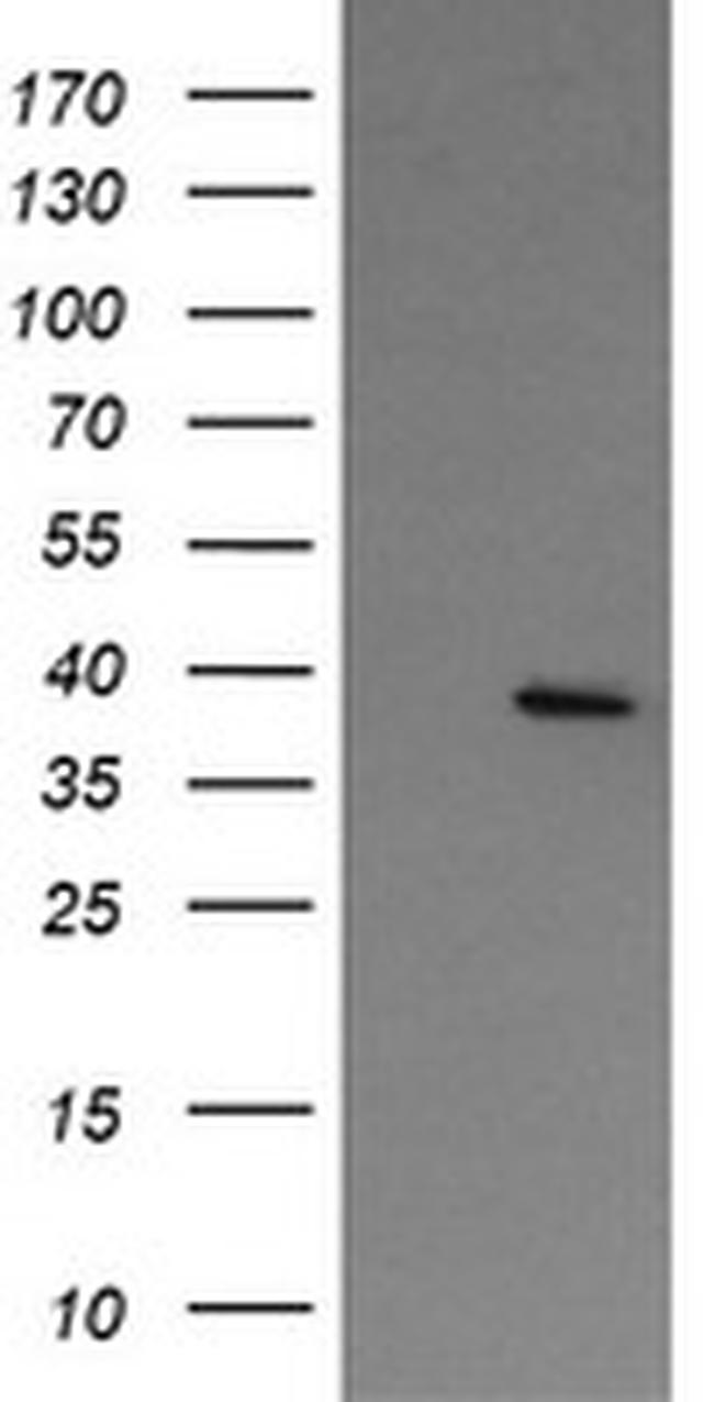 NUDT9 Antibody in Western Blot (WB)