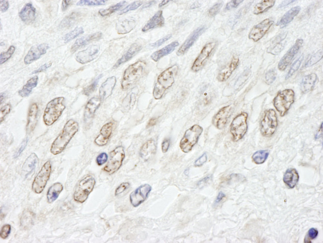 NUP50 Antibody in Immunohistochemistry (IHC)
