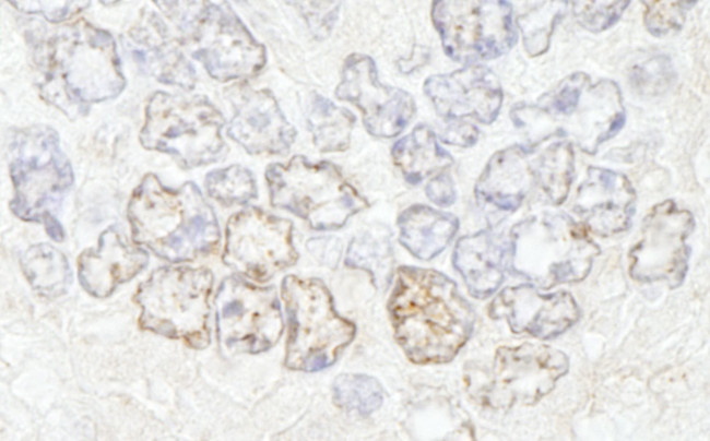 NUP50 Antibody in Immunohistochemistry (IHC)