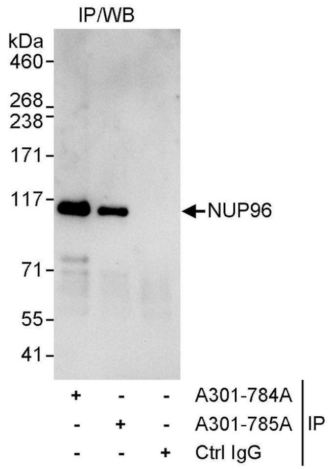 NUP96 Antibody in Immunoprecipitation (IP)