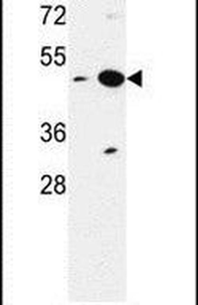 NUPL2 Antibody in Western Blot (WB)