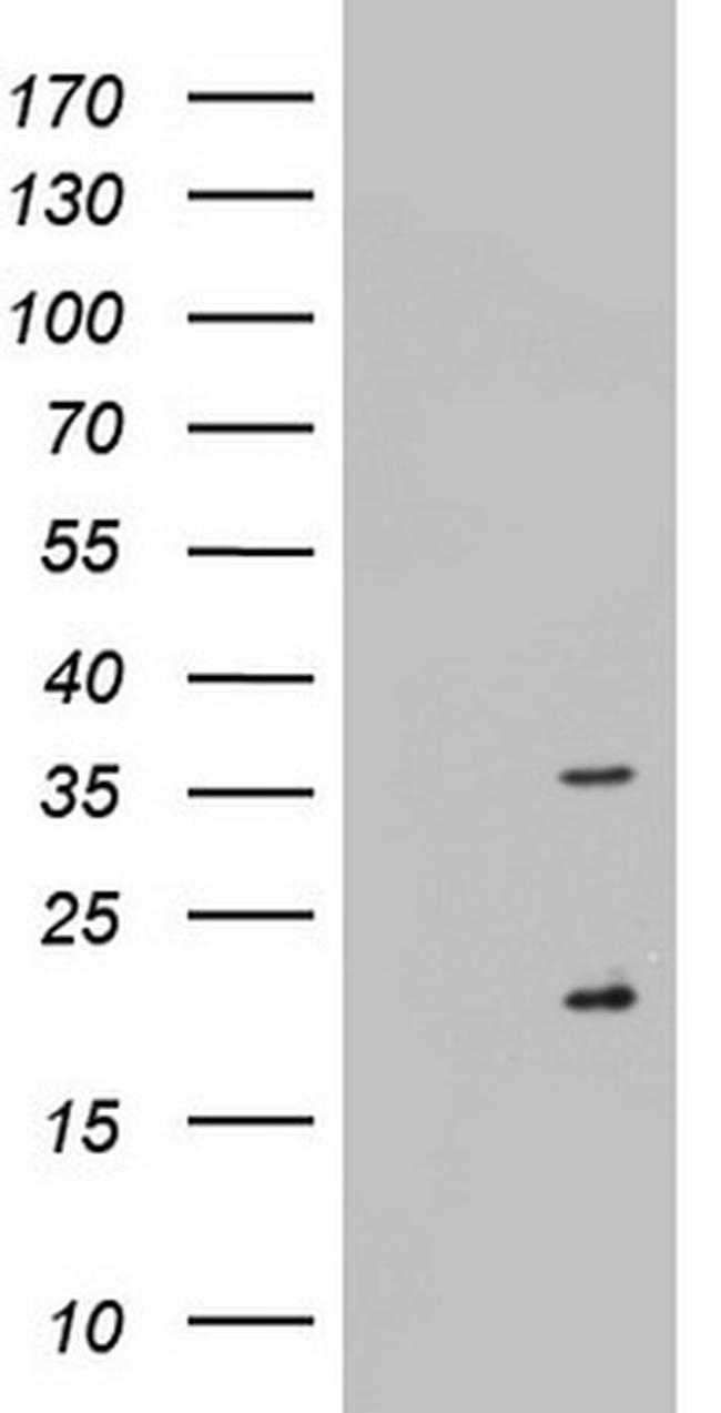 NUS1 Antibody in Western Blot (WB)