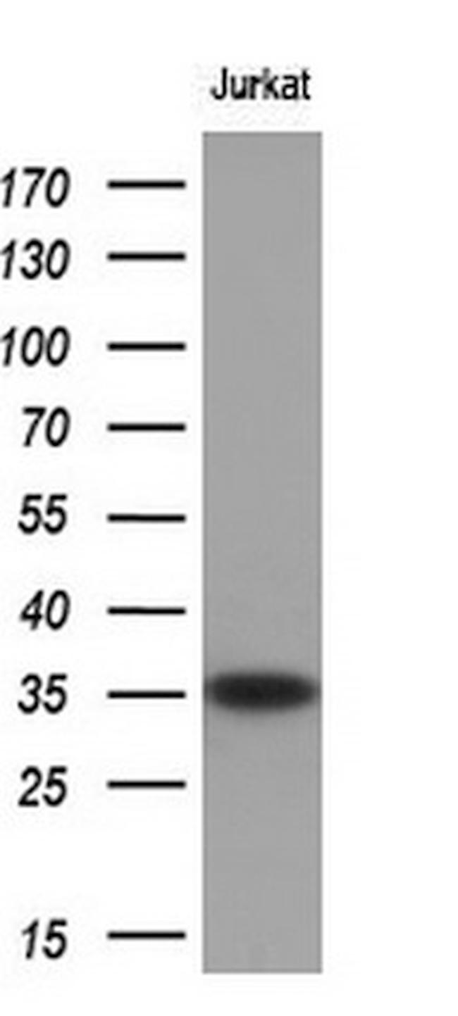 Nkx3.1 Antibody in Western Blot (WB)