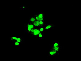 Notch1 Antibody in Immunocytochemistry (ICC/IF)