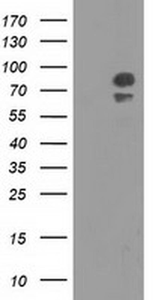 OSBPL11 Antibody in Western Blot (WB)