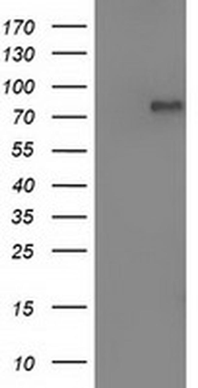 OSBPL11 Antibody in Western Blot (WB)
