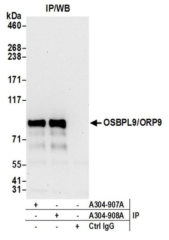 OSBPL9/ORP9 Antibody in Western Blot (WB)