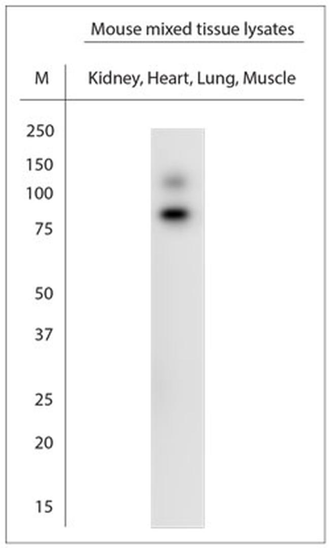 KCNH2 Antibody in Western Blot (WB)