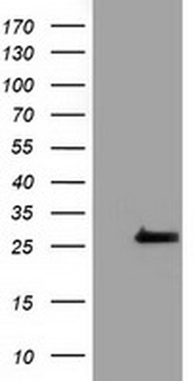 OTUB2 Antibody in Western Blot (WB)