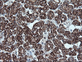 CDKN2A (p16INK4a) Antibody in Immunohistochemistry (Paraffin) (IHC (P))