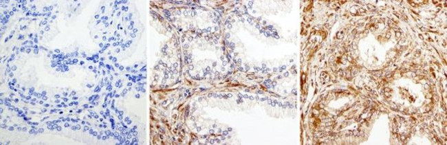 RAC1 Antibody in Immunohistochemistry (Paraffin) (IHC (P))