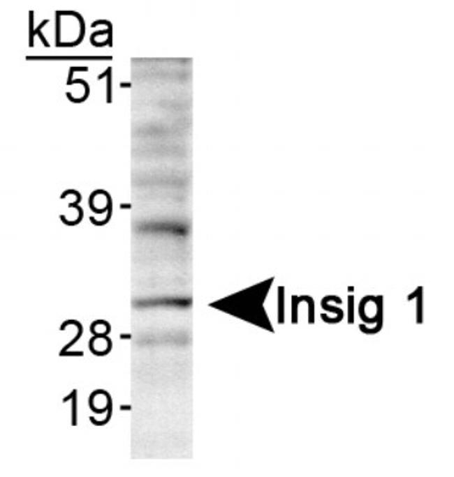 INSIG1 Antibody in Western Blot (WB)