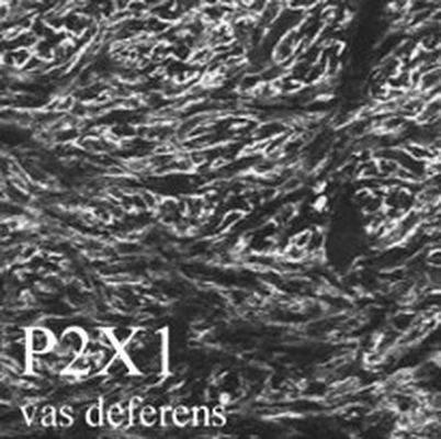 P2X1 Antibody in Immunohistochemistry (IHC)