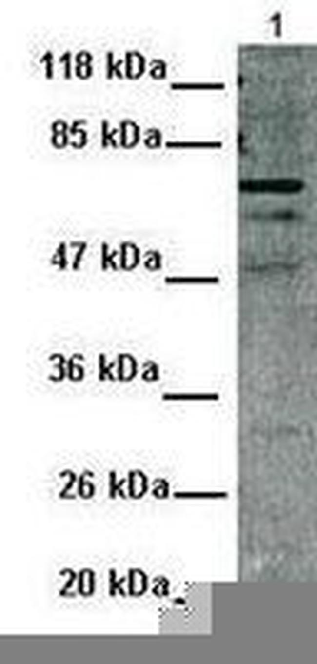 MDMX Antibody in Western Blot (WB)