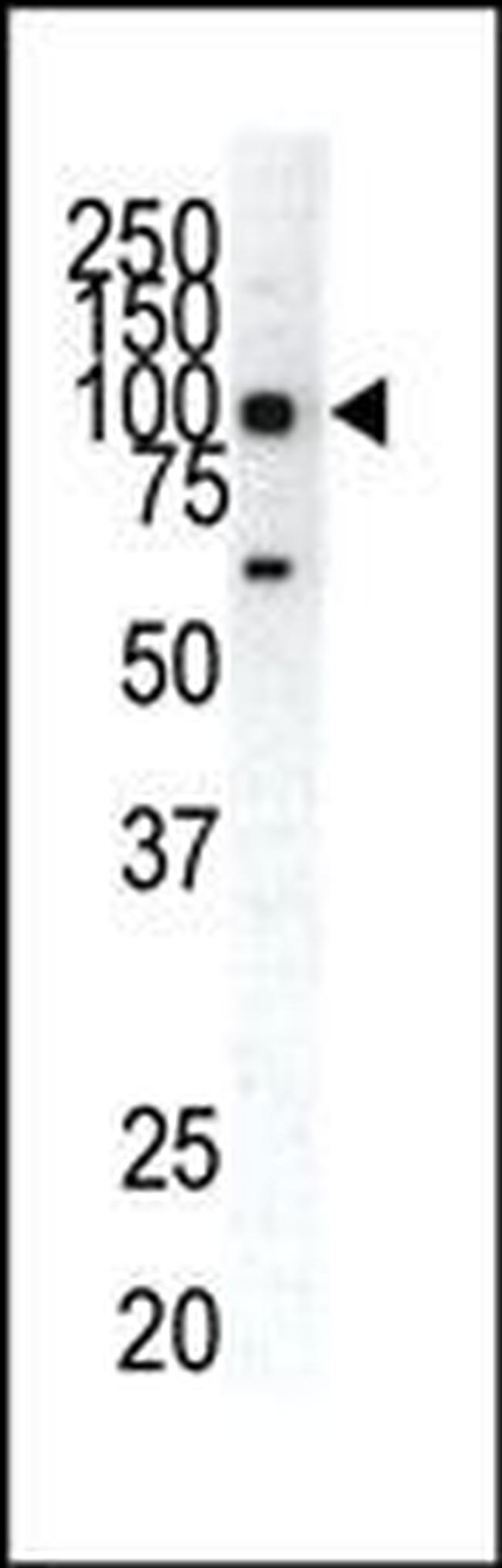 EphA1 Antibody in Western Blot (WB)