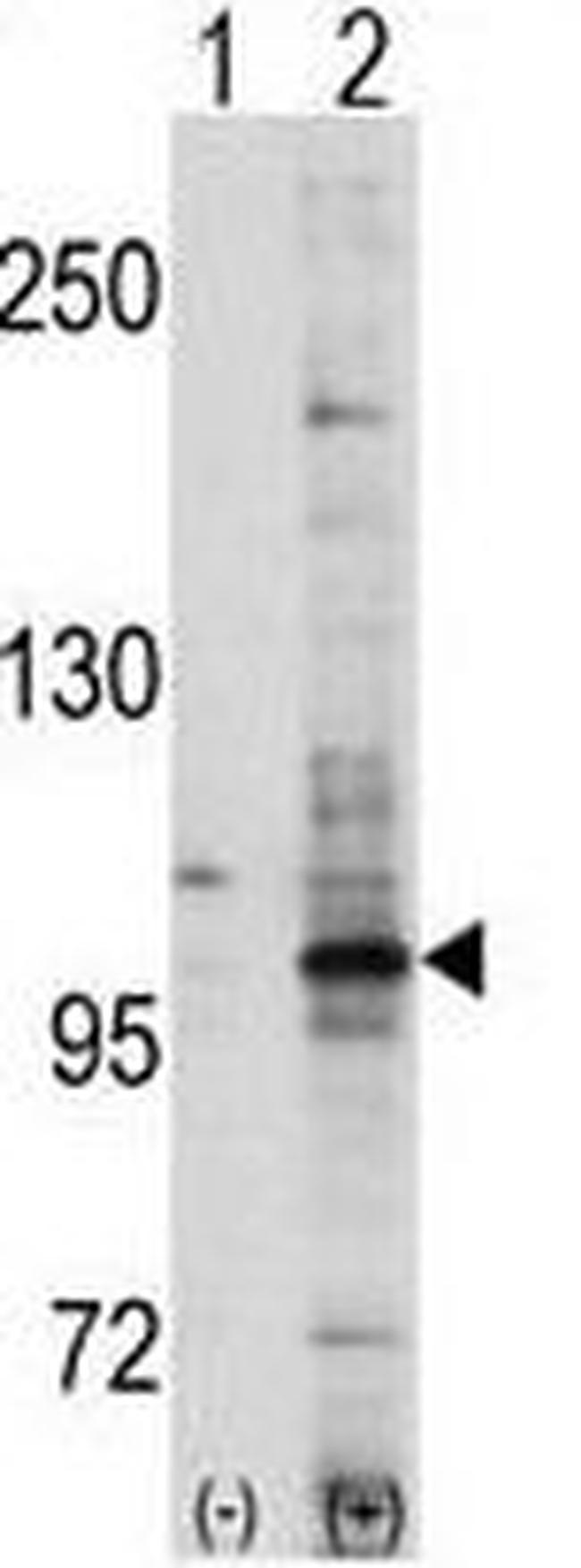 EphA7 Antibody in Western Blot (WB)