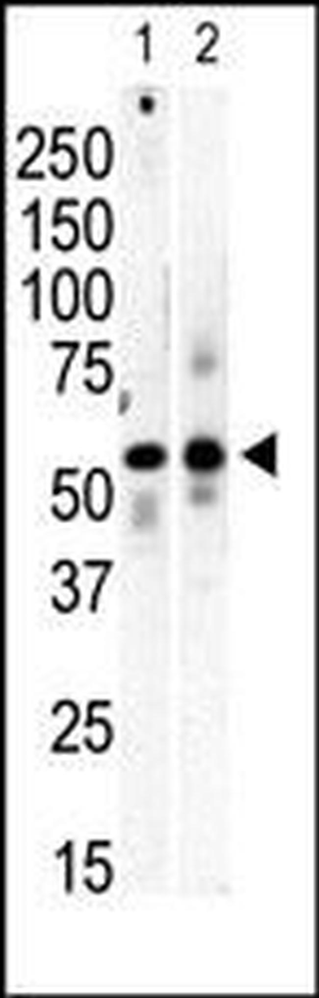 PI4K2B Antibody in Western Blot (WB)