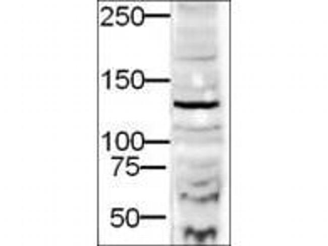DIAPH2 Antibody in Western Blot (WB)