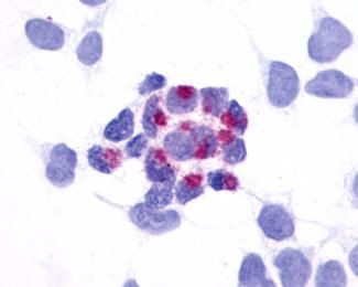 GPR161 Antibody in Immunocytochemistry (ICC/IF)