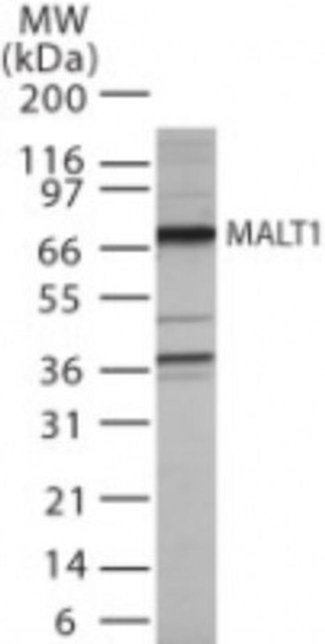 MALT1 Antibody in Western Blot (WB)