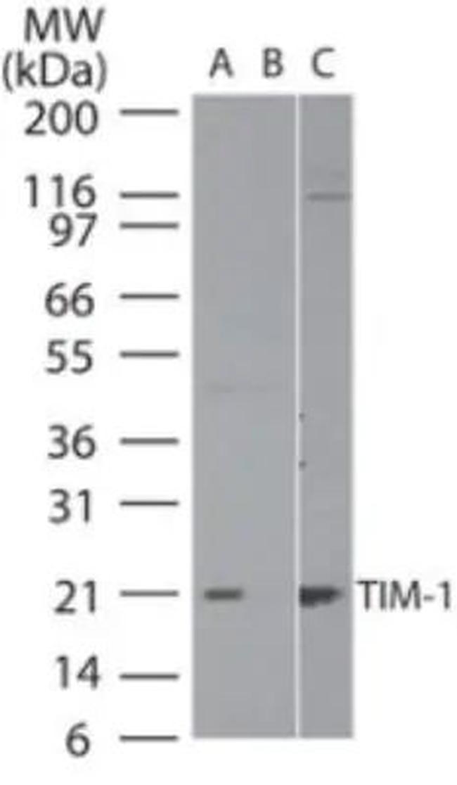 TIM-1 Antibody in Western Blot (WB)