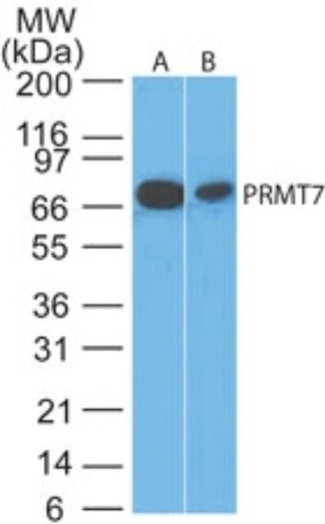 PRMT7 Antibody in Western Blot (WB)