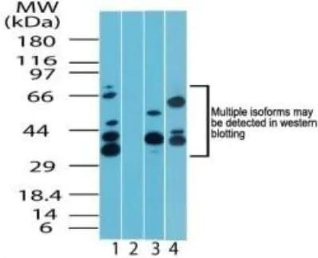 TNPO1 Antibody in Western Blot (WB)