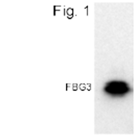 FBXO44 Antibody in Western Blot (WB)