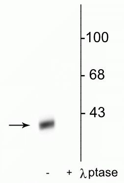 Phospho-DARPP-32 (Thr34) Antibody in Western Blot (WB)