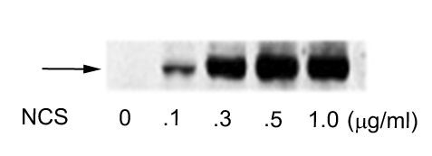 Phospho-ATF2 (Ser490, Ser498) Antibody in Western Blot (WB)