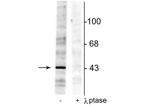 Phospho-EphB2 (Tyr298) Antibody in Western Blot (WB)