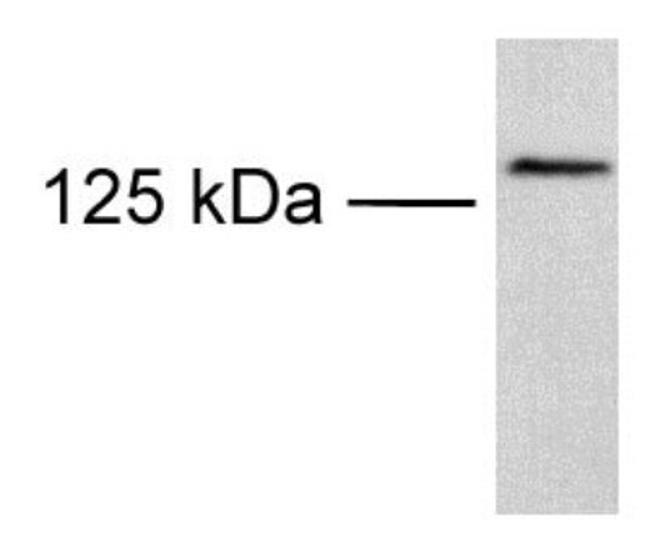 TRPM8 Antibody in Western Blot (WB)