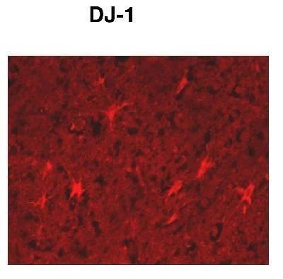 DJ-1 Antibody in Immunohistochemistry (Paraffin) (IHC (P))